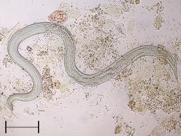 Adult female of Strongyloides stercoralis collected in bronchial fluid of a patient with disseminated disease. Scale bar = 400 µm.