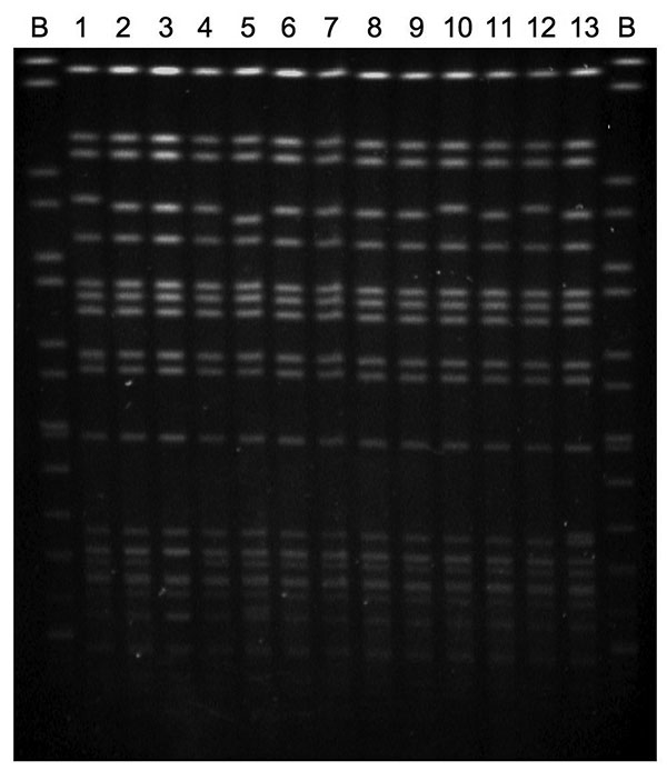 Pulsed-field gel electrophoresis patterns of rmtC-positive Salmonella enterica serovar Virchow isolates. Lanes: B, S. Braenderup H9812 size standard; 1, H0 5164 0340; 2, H0 5366 0426; 3, H0 6018 0151; 4, H0 6136 0322; 5, H0 6398 0463; 6, H0 7078 0136; 7, H0 7310 0210; 8, H0 7468 0335; 9, H0 7474 0467; 10, H0 7496 0137; 11, H0 7512 0259; 12, H0 8354 0857; and 13, H0 8512 0713.