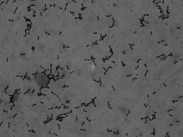 Gram-positive cocci, mostly in pairs and short chains, found in cerebrospinal fluid from a 34-year-old man with Streptococcus suis meningitis. The sample was not centrifuged before staining. Original magnification ×1,000.