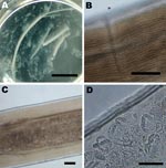 Thumbnail of Images of the adult female Dirofilaria repens worm removed from a subcutanous nodule of the patient. A) Macroscopic view of sections of the worm in saline in a petri dish. Two uteri and the intestinal tract can be seen protruding from a disrupted end of the largest section. The saline is turbid due to the massive release of microfilariae, which are not discernible at this magnification. Scale bar = 1 cm. B) Microscopic view of the outer cuticula with multiple longitudinal ridges. Sc