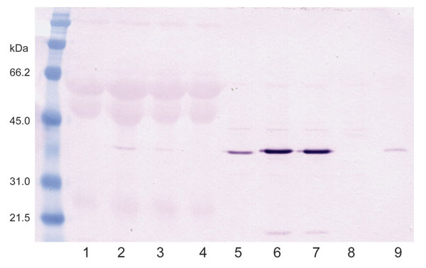 Western blot of infected duck embryonic fibroblasts (DEFs) showing avian bornavirus N-protein during culture. Lanes 1–4 are supernatant fluids. Lane I is from an African gray parrot (AG5). Lanes 2 and 3 are from a yellow-collared macaw (M24). Lane 4 is from uninfected DEFs. Lanes 5–8 are sonicated cell extracts. Lane 5 from AG5; 6 and 7 from M24; and Lane 8 from uninfected DEFs. Lane 9 is an infected brain control. The virus is strongly cell associated.