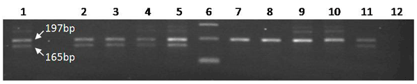 Amplification of the chemokine receptor 5 (CCR5) Δ32 locus in white patients. Lane 1, heterozygous positive control; lanes 2–5 and 7–11, patient samples; lane 6, 100-bp ladder; lane 12, negative control. CCR5Δ32 heterozygosity is observed in samples 2, 3, 4, 5, and 11.