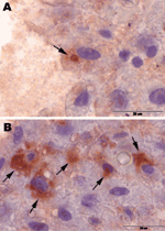 Thumbnail of Immunohistochemical staining (peroxidase-antiperoxidase (PAP) technique) of liver samples from 2 rat-hepatitis E virus (HEV)–positive Norway rats from Germany, July 2009. Arrows indicate immunohistochemical positive reactions in the cytoplasm of single hepatocytes (A) and in a few foci in hepatocytes and stellate cells (B). For PAP staining, deparaffinized slides of liver samples were incubated with anti-HEV–positive human serum, which had been previously used to detect rat HEV by u