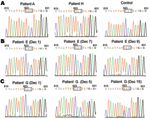 Thumbnail of Evolution of oseltamivir-sensitive H275 in pandemic (H1N1) 2009 virus to oseltamivir-resistant virus (mutation Y275) in the neuraminidase (NA) gene, South Korea. A) NA sequences of viruses from patient A, patient H, and strain A/Korea/01/2009 (H1N1) (Control) (Table 2). Viruses from these 2 patients had triplet TAC (encoding tyrosine in NA 275), indicating that these patients were infected with oseltamivir-resistant virus, in contrast to A/Korea/01/2009 (H1N1) of the oseltamivir-sen