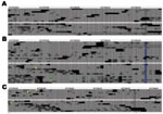 Thumbnail of Alignment of Coccidioides immitis whole-genome sequence reads flanking a confirmed single-nucleotide polymorphism (RSv3 supercontig 1, position 6729646, highlighted in blue in panel B) among the 3 cluster isolates. Isolates from patients X, Y, and Z, who had coccidioidomycosis, are shown in panels A, B, and C, respectively. The alignment was created by using SolScape, a short-read sequence-alignment viewer developed in house (J. Pearson et al., unpub. data; tool available upon reque