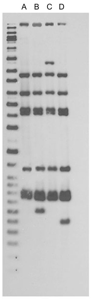 IS6110 restriction fragment length polymorphism patterns for tuberculosis patients, New York, New York, USA, 2003–2009. Left lane, molecular mass ladder; lane A, n = 48; lane B, n = 1; lane C, n = 1; lane D, n = 4. Spoligotype results (octal code designation) were 777777774020771 for 54 patients. Twelve-loci mycobacterial interspersed repetitive-unit variable-number tandem repeat results were 225313153321 for 53 patients and 2253131–3321 for 1 patient; the dash indicates that there was no peak a