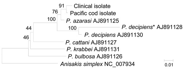 Phylogenetic analysis of members of Pseudoterranova decipiens species complex roundworms. Genetic relationships between NADH dehydrogenase subunit 1 sequences in clinical and Pacific cod isolates and species were inferred by using the neighbor-joining method. Bootstrap values (1,000 replicates) are shown next to the branches. The final dataset contained 498 positions. *P. decipiens sensu stricto. Scale bar indicates nucleotide substitutions per site.