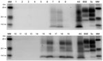 Thumbnail of Western immunoblots showing clear atypical scrapie profiles in sheep in the following brain regions; brainstem of donor ARRa (lane 7), frontal cortex of donor ARRb (lane 8) and frontal cortex of donor AHQ (lane 19). The hippocampus and basal nuclei of recipient animal 11 (lanes 15 and 16, respectively) and cerebellum of recipient animal 12 (lane 18). No discernible signal was seen in the medulla of donor ARRb (lane 9), and only a faint profile was visible for the obex of recipient a