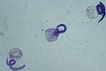 Thumbnail of Viable Baylisacaris procyonis larvae demonstrating intact membrane and impermeability to methylene blue. Original magnification ×40.