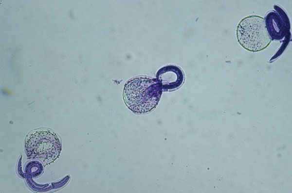 Viable Baylisacaris procyonis larvae demonstrating intact membrane and impermeability to methylene blue. Original magnification ×40.