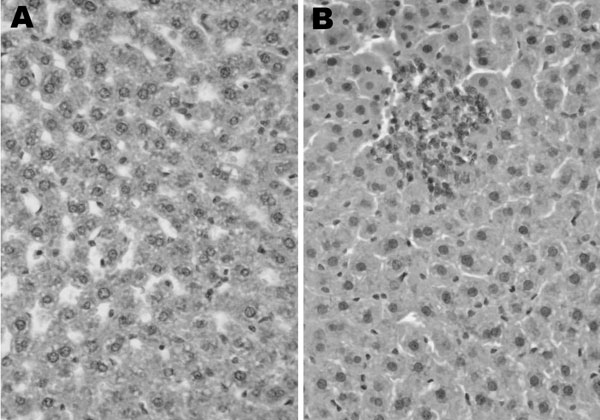 Histologic analysis of infection with rat hepatitis E virus, Los Angeles, California, USA. Hematoxylin and eosin–stained sections of liver from a healthy rat (A) and a rat acutely infected with rat HEV (B). Original magnification ×200.