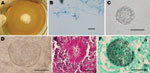 Thumbnail of Coccidioidal structures obtained from a naturally infected Carollia perspicillata bat (upper images) and experimentally infected mice (lower images). A) Mature spherule filled with endospores in lung tissue (KOH 10%) of bat. B) Macroscopic aspect of Coccidioides posadasii culture recovered from homogenate of bat lungs. C) Microscopic view of C. posadasii culture from bat lungs showing hyaline hyphae with arthroconidia and disjunctor cells (lactophenol cotton blue staining). D) Burst