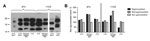 Thumbnail of PrPSc profile of macaque-adapted BSE in comparison to human CJD. Brain homogenates from human sCJD type 1, sCJD type 2, vCJD, and BSE-infected macaques were subjected to PK treatment, separated on 12% sodium dodecyl sulfate–polyacrylamide gel electrophoresis, and blotted onto nitrocellulose membranes. A) PrPSc for human and macaque brain was detected with the widely used monoclonal antibody 3F4 or with 11C6. B) Glycoform ratio of sCJD type 2, vCJD, and macaque-adapted BSE. The relat