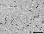 Thumbnail of In situ detection by using Nomarski differential interference contrast microscopy of Schmallenberg virus mRNA in neurons in the medulla of a neonatal sheep for which Schmallenberg virus infection was confirmed by real-time quantitative reverse transcription PCR. Scale bar = 100 μm.