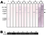 Thumbnail of Raccoon polyomavirus (RacPyV) is episomal in raccoon brain tumors as detected by Southern blot hybridization and rolling circle amplification. A unique KpnI site in viral protein 1 (Technical Appendix Figure 2) conserved across the viral genomes was predicted to linearize circular RacPyV DNA. Genomic DNA was KpnI digested and probed with a 799-bp probe designed to hybridize to large T-antigen (Technical Appendix Figure 3). A) Southern blot hybridization. DNA digested with KpnI (K) a