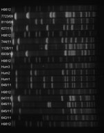 Thumbnail of Pulsed-field gel electrophoresis of Streptococcus equi subspecies zooepidemicus isolates using SmaI. The lanes are marked with the number of the respective isolate. DNA of Salmonella enterica serovar Braenderup H9182 was used as a molecular marker.