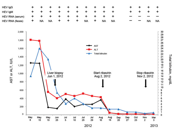 Clinical and laboratory data for a 60-year-old man with hepatitis E and lymphocytic leukemia, Italy, 2012.  Start of ribavirin treatment and virologic response are indicated. A differential diagnosis was obtained by using abdominal ultrasound, which showed an enlarged hypoechogenic liver and thickening of the gallbladder wall (5 mm) with gallstones in the lumen, but a regular biliary tree. An enlarged spleen (bipolar diameter 15.07 cm) and lymph nodes were attributed to chronic lymphocytic leuke