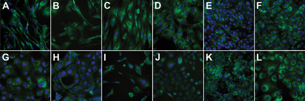 Immunofluorescence staining of the Middle East respiratory syndrome coronavirus receptor dipeptidyl peptidase 4 (DPP-4; rabbit anti-CD26/DPP-4 polyclonal antibody; Bioss Inc., Woburn, USA) in cell lines used to guide the search for the intermediate host of the virus. Counterstaining of nuclei was done by using 4′,6-diamidino-2-phenylindole. Cell lines: A) ZN-R, B) ZLu-R, C) LGK-1-R, D) TT-R.B, E) PO, F) KN-R, G) KLu-R, H) MyglaAEC.B, I) Crocsu-Lu, J) PipNi, K) A549, and L) Vero E6. Magnification