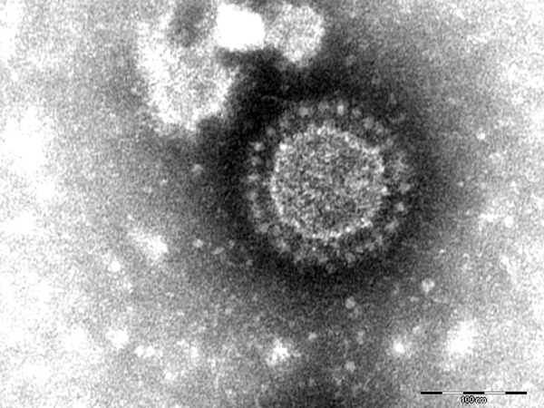 Porcine epidemic diarrhea virus particles seen by negative-stain electron microscopy of fecal samples. Negative staining with 1% phosphotungstic acid. Scale bar indicates 100 nm.