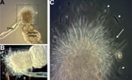 Thumbnail of Sandflies infected with Leishmania infantum from US foxhounds, showing blocked stomodeal valve. Development of L. infantum (MCAN/US/2001/ FOXYMO1) in laboratory-reared Lutzomyia longipalpis sandflies led to stomodeal valve blockage 10–13 days after infection. A) Dissected gut of infected sandfly, showing stomodeal valve (cardia) obstructed by Leishmania parasites (dashed box). Foregut removed during dissection and parasites entangled by flagella are visible. Original magnification ×