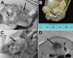 Thumbnail of Multiple Echinococcus vogeli cysts (larval stage) in the liver of a wild paca. A, B) Vesicles exposed at the hepatic surface (arrows). C, D) Transected larvae in thick sections of liver showing internal structure of vesicles and characteristic distribution of brood capsules (arrows). Ruler in panel B indicates centimeters.