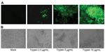 Thumbnail of Replication of porcine epidemic diarrhea virus (PEDV) in a newly established immortalized duck intestinal epithelial cell line (MK-DIEC) infected with PEDV at a multiplicity of infection of 0.1 in the presence of different concentrations of trypsin. A) Twenty-four hours after infection, PEDV nucleoprotein in infected cells was detected by immunofluorescence assay using fluorescein isothiocyanate–labeled nucleoprotein-specific monoclonal antibody. B) PEDV-induced cytopathic effect in