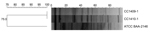 Thumbnail of Dendrogram of pulsed-field gel electrophoresis patterns showing the genetic relationship between 2 Klebsiella pneumoniae isolates co-producing New Delhi metallo-β-lactamase 5 and oxacillinase 181 carbapenemases, South Korea, 2014. ATCC BAA-2146 indicates New Delhi metallo-β-lactamase 1 K. pneumoniae used as a reference strain.