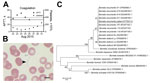 Thumbnail of Laboratory findings of hemorrhagic diathesis in an 18-year-old Somalian refugee to Germany with Borrelia recurrentis infection, August 2015. A) Time course of coagulation parameters (thrombocytopenia and prolongation of activated partial thromboplastin time). B) Extracellular spirochetes demonstrated by light microscopy (arrowhead). Representative image detail from thin blood smear, Giemsa stain. Original magnification ×100. C) Molecular phylogenetic analysis of B. recurrentis detec