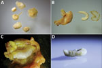 Thumbnail of Resected cystic pentastomid lesions extracted from patients during abdominal surgery, Sankuru District, Democratic Republic of the Congo, 2014–2015. A) Six abdominal cysts resected from patient 3, who was found to be coo-infected: 3 cysts each were Armillifer grandis and A. armillatus larvae, as determined by PCR. B) One of 2 resected A. armillatus cysts from patient 5. The fibrous capsule, the larva itself, and the parasite’s exuvia are shown. The larva has 20 annulations, morpholo