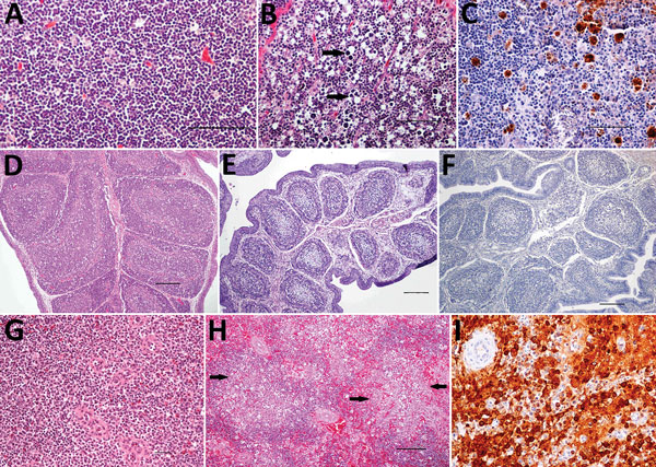 Histopathologic and immunohistochemical (IHC) findings in lymphoid organs of control and infected common eider (Somateria mollissima) ducklings experimentally infected with Wellfleet Bay virus (WFBV) (2 days postinoculation). A) Hematoxylin and eosin (H&amp;E) stain of thymic cortex tissue from a control duckling. B) H&amp;E stain of thymic cortex tissue from an infected duckling, showing marked multifocal acute apoptosis of lymphocytes (arrows). C) IHC stain of thymus tissue from an infected du