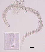 Thumbnail of Size and shape of a Dracunculus medinensis third-stage larva recovered from a Phrynobatrachus francisci frog from Chad. Scale bar indicates 25 μm. Inset shows detailed morphology of the tip of the tail of the larva, including the characteristic 3-lobed tip.