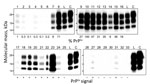 Thumbnail of Western blot analysis of proteinase K–resistant disease-associated prion protein (PrPSc) in tissue samples obtained from a cow at 88 months after oral inoculation with brain homogenate of L-type bovine spongiform encephalopathy (BSE) agent. The tissues tested are shown by lane: 1, olfactory bulb; 2, frontal cortex; 3, piriform cortex; 4, parietal cortex; 5, occipital cortex; 6, hippocampus; 7, putamen; 8, thalamus; 9, hypothalamus; 10, midbrain (superior colliculus); 11, obex; 12, c