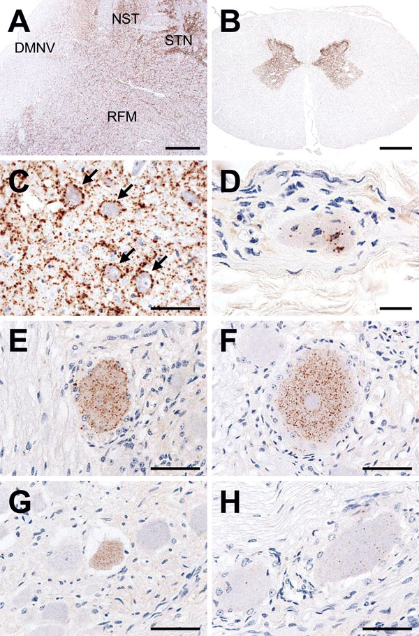 Immunohistochemical detection of disease-associated prion protein (PrPSc) in a cow at 88 months after oral inoculation with brain homogenate of L-type bovine spongiform encephalopathy agent. A) Low amount of PrPSc deposition in the dorsal motor nucleus of the vagus nerve (DMNV) compared with the more pronounced depositions in the solitary tract nucleus (NST), the spinal tract of trigeminal nerve (STN), and the reticular formation (RFM) in the medulla oblongata at the obex level. Scale bar indica