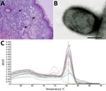 Thumbnail of Results from necropsy of Tonkean macaque (Macaca tonkeana) from animal sanctuary, Italy, January 2015. A) Hematoxylin and eosin stain of cutaneous lesion. Focal epidermal necrosis, acanthosis ballooning degeneration, and acantholysis of keratinocytes was observed. Staining shows early vesiculation with eosinophilic intracytoplasmic inclusion bodies (arrows) in enlarged degenerated cells. B) Electron micrograph of skin lesion sample showing negatively stained brick-shaped viral parti