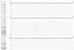 Thumbnail of Comparison of amino acid composition of E2 region human pegivirus sequence variants amplified from serum and cerebrospinal fluid from 3 patients with encephalitis of unclear origin, Poland, 2012–2015. Numbers in parentheses represent the number of reads representing a given sequence. Shading indicates sequences unique to cerebrospinal fluid. C, cerebrospinal fluid; S, serum. 