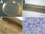 Thumbnail of Dirofilaria repens adult worm isolated from the right conjunctiva of a 76-year-old man who returned to Belgium from Senegal, and microfilaria detected by using the Knott test. A) Macroscopic image of the adult. B) Microscopic image of the adult cuticle, showing the typical longitudinal ridges. Scale bar indicates 200 μm. C) Eggs in utero, indicating that the adult is a gravid female worm. Scale bar indicates 50 μm. Panel C has been cropped and contrast was increased to improve visib