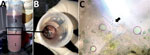 Thumbnail of Zçaí berry juice sample from Brazilian Amazon. A) A 50 mL-tube after centrifugation shows 3 layers: 1, pulp, 2, intermediate fat (box); and 3: supernatant. B) Top view of layer 2 (arrow). C) Fresh preparation of layer 2 showing Trypanosoma cruzi flagellated form (arrow).