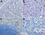 Thumbnail of Double immunohistochemical staining of Ebola virus (red) and CD163 antigen (brown) in tissues of patients who died of noninfectious causes. CD163 antigens in macrophages of heart (A), liver (Kupffer cells) (B), spleen (C), and testicle (D). Original magnification ×20.