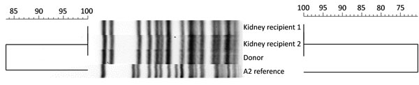 Pulsed-field gel electrophoresis (PFGE) and whole-genome multilocus sequence typing (wgMLST) comparisons of Francisella tularensis A2 strains. PFGE banding patterns and PFGE and wgMLST cluster analysis are shown for isolates from the organ donor and kidney recipients in relation to the F. tularensis A2 reference (strain WY96-3418). Dendrograms indicate percentage strain similarity for PmeI PFGE (left) and wgMLST (right). 