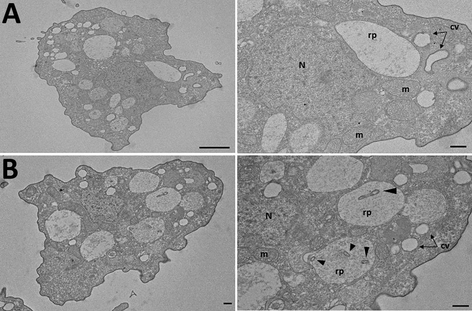 Transmission electron micrograph at of amebae isolated from the home hot tub of a an immunocompromised 3-year-old girl with legionellosis before and after coculture with Legionella pneumophila, Calgary, Alberta, Canada. A) Trophozoites of Vermamoeba vermiformis before coculture. Note the absence of intracellular bacteria in the replicative phagosome. B) V. vermiformis replicative phagosome containing L. pneumophila serogroup 6 after 6 h of coculture. Arrows indicate L. pneumophila contained with