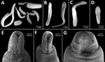 Thumbnail of Microphotographs of Dibothriocephalus spp. plerocercoids from 3 salmonid species in Lago Gutiérrez, Patagonia, Argentina. A) D. dendriticus and D. latus plerocercoids from Oncorhynchus mykiss rainbow trout. B) D. latus plerocercoids from Salvelinus fontinalis brook trout. C) D. dendriticus plerocercoids from Salmo trutta brown trout. D) D. latus plerocercoids from S. trutta brown trout. E, F) D. dendriticus plerocercoids from O. mykiss rainbow trout. G) D. latus plerocercoids from S