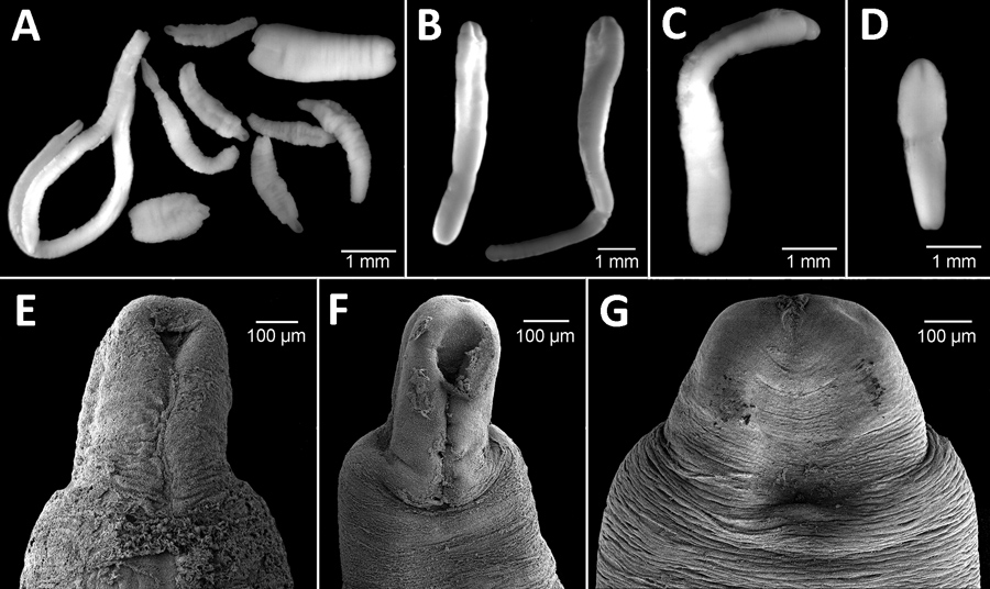 Microphotographs of Dibothriocephalus spp. plerocercoids from 3 salmonid species in Lago Gutiérrez, Patagonia, Argentina. A) D. dendriticus and D. latus plerocercoids from Oncorhynchus mykiss rainbow trout. B) D. latus plerocercoids from Salvelinus fontinalis brook trout. C) D. dendriticus plerocercoids from Salmo trutta brown trout. D) D. latus plerocercoids from S. trutta brown trout. E, F) D. dendriticus plerocercoids from O. mykiss rainbow trout. G) D. latus plerocercoids from S. fontinalis 