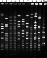 Pulsed-field gel electrophoresis patterns of invasive Haemophilus influenzae isolates collected during 2019–2020, Gipuzkoa, northern Spain. Lane 1, ST103; lane 2, ST760; lanes 3–4, ST23 isolates; lane 5, ST393; lane 6, ST6; lane 7, ST995; lane 8, ST2053; lane 9, ST46; lane 10, control isolate ATCC49766; lane MW, 50 kb DNA ladder. ST, sequence type; MW, molecular weight.