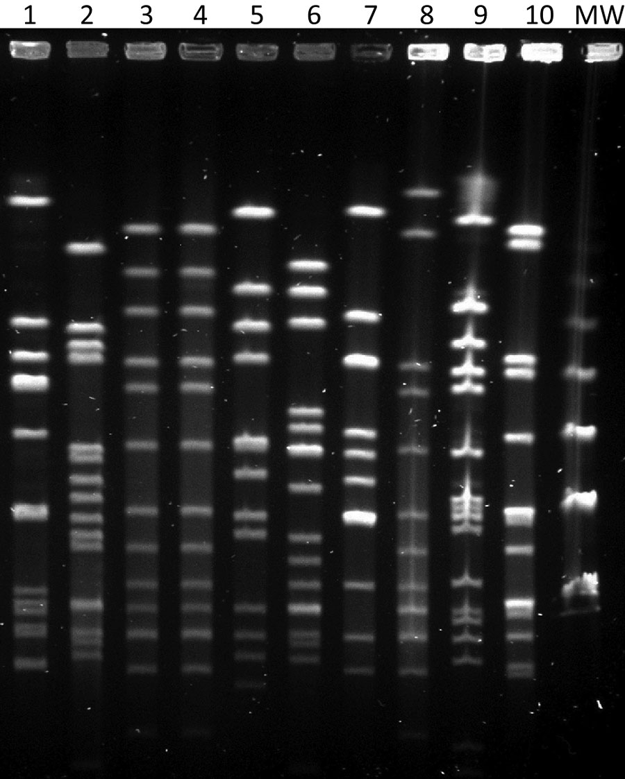 Pulsed-field gel electrophoresis patterns of invasive Haemophilus influenzae isolates collected during 2019–2020, Gipuzkoa, northern Spain. Lane 1, ST103; lane 2, ST760; lanes 3–4, ST23 isolates; lane 5, ST393; lane 6, ST6; lane 7, ST995; lane 8, ST2053; lane 9, ST46; lane 10, control isolate ATCC49766; lane MW, 50 kb DNA ladder. ST, sequence type; MW, molecular weight.