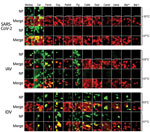 Tropisms of SARS-CoV-2, IAV, and IDV in infected airway epithelial cell cultures from diverse mammal species. We inoculated well-differentiated animal airway epithelial cell cultures with either 30.000 PFU of SARS-CoV-2 (SARS-CoV-2/München-1.1/2020/929), 10.000 50% tissue culture infective dose of IAV/Hamburg/4/2009, or IDV (D/bovine/Oklahoma/660/2013). We incubated virus-infected airway epithelial cell cultures at 33°C or 37°C and formalin-fixed them at 96 hours postinfection (for SARS-CoV-2) or 48 hours postinfection (for influenza viruses). After fixation, we stained virus-infected cultures using antibodies against either SARS-CoV-2, IAV, or IDV NP (green), and β-tubulin (cilia, red). We acquired images using an EVOS FL Auto 2 Imaging System equipped with a 40x air objective. Scale bar indicates 50 µm. *Sturnira lilium bat; †Carollia perspicillata bat. IAV, influenza A virus; IDV, influenza D virus; NP, nucleocapsid protein; SARS-CoV-2, severe acute respiratory syndrome coronavirus 2.