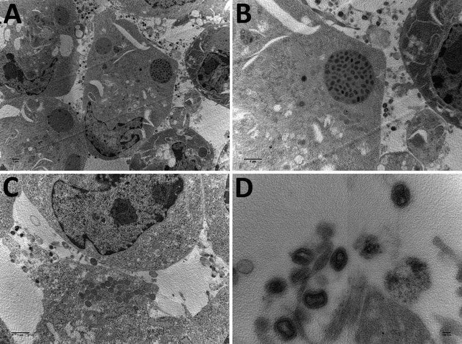 Electron microscopy images of cowpox virus CPXV-54-1716-France (CPXV-like 2), obtained from a pregnant woman in France, 2017. A) Ultrathin sections of BHK-21 cell at 42 hours after infection. Arrow indicates a typical inclusion in the cell cytoplasm. Original magnification ×4,600. B) Higher magnification of BHK-21 cell in panel A. Original magnification ×46,000. C) Ultrathin section of a BHK-21 cell with typical viral factories near the nucleus. Arrows indicate incomplete viruses. Original magnification ×10,500. D) Extracellular-enveloped viruses (arrow). Original magnification ×10,500.