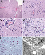 Pathologic changes in brain of free-ranging black-tufted marmosets with fatal human alphaherpesvirus 1 infection, Brazil, 2012–2019. A) Necrotizing meningoencephalitis. Hemotoxylin and eosin (H&E) stain; original magnification ×10. B) Neuronal degeneration and glial nodule. H&E stain; original magnification ×40. C) Neuronal necrosis with microglial proliferation and expansion of Virchow–Robbin spaces by lymphocytes, histiocytes, and few plasma cells. Neurons and glial cells show intranuclear inclusion bodies and prominent margination of the nuclear chromatin. H&E stain; original magnification ×63. D) Prominent neutrophilic inflammation accompanies neuronal necrosis and intranuclear inclusion bodies. H&E stain; original magnification ×63. E) Human alphaherpesvirus 1 immunostaining within neurons (immunohistochemistry; original magnification ×40). F) Intranuclear (arrowhead) and cytoplasmic (arrow) herpesvirus particles in gray matter. Transmission electron microscopy; scale bar indicate 500 nm. Inset: cytoplasmic herpesvirus particles (arrow) white matter, myelinated axon (arrowhead); scale bar indicates 200 nm.