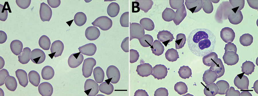 Thin films of a blood sample collected in October 2019 from a patient in French Guiana. Inclusions of Candidatus Anaplasma sparouinense are located at the periphery of the red blood cells as small round dots of 0.3–0.4 µm (arrowheads). Other red blood cells contain Howell-Jolly bodies of various shapes and sizes >1 µm (arrows). Some Howell-Jolly bodies are found in the background of the smears. Wright-Giemsa stain; original magnification ×100.