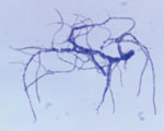 Photomicrograph of Dermatophilus congolensis, showing a Giemsa-stained, Gram-positive bacteria. Source: Dr. Jerrold Kaplan, Centers for Disease Control, 1965.