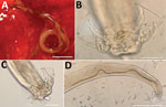 Angiostrongylus cantonensis lungworms from lungs of rats trapped in Valencia, Spain, 2021. A) Adult female with characteristic barber-pole appearance. Scale bar indicates 500 μm. B, C) Copulatory bursae of 2 male worms supported by bursal rays. Scale bars indicate 50 μm. D) Detail of the long spicula of a male worm. Scale bar indicates 300 μm.